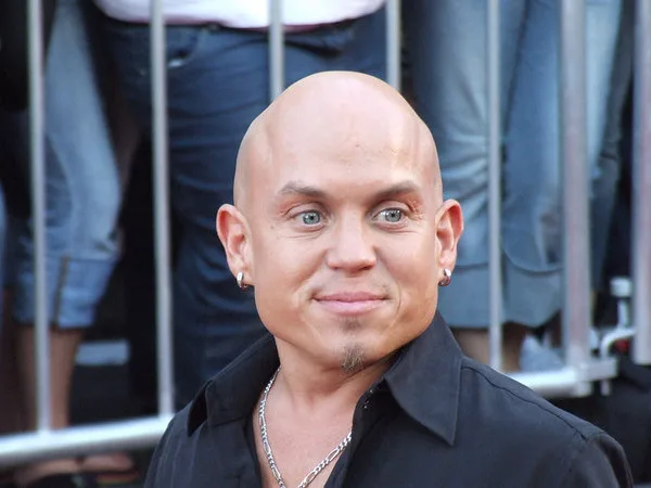 تصویر Martin Klebba