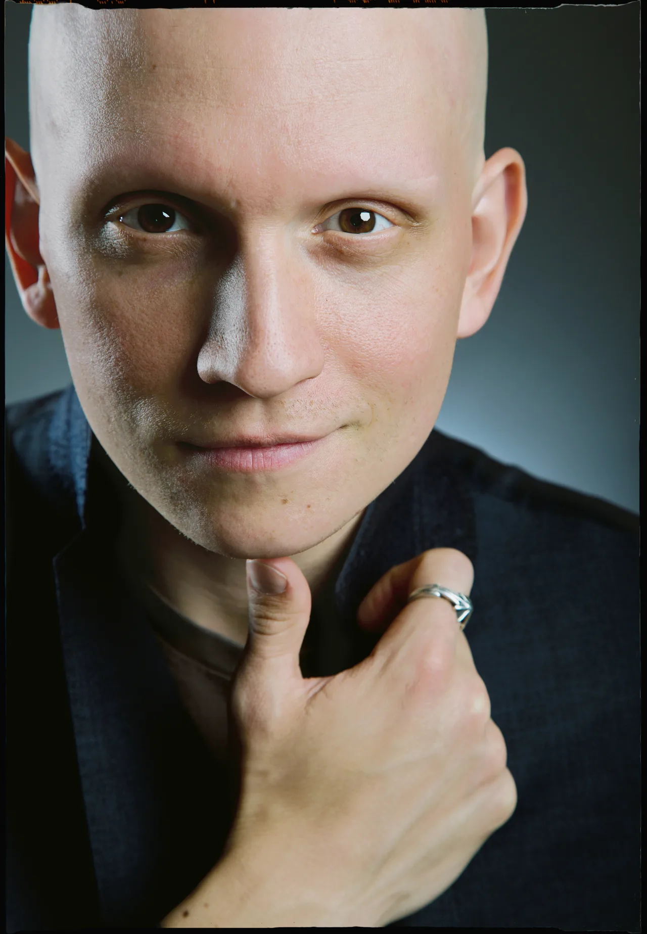 تصویر Anthony Carrigan